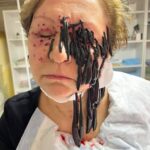 « L&rsquo;HIRUDOTHÉRAPIE EN TANT QUE MÉTHODE DE TRAITEMENT SYSTÉMIQUE SELON LA MÉTHODE DU DOCTEUR NERON NAM : FONDEMENTS BIOLOGIQUES ET APPLICATION CLINIQUE »